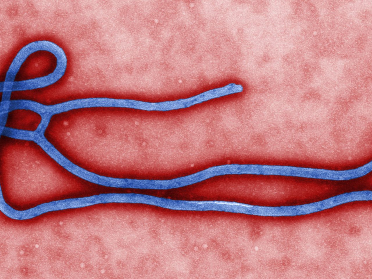 Ebola virus