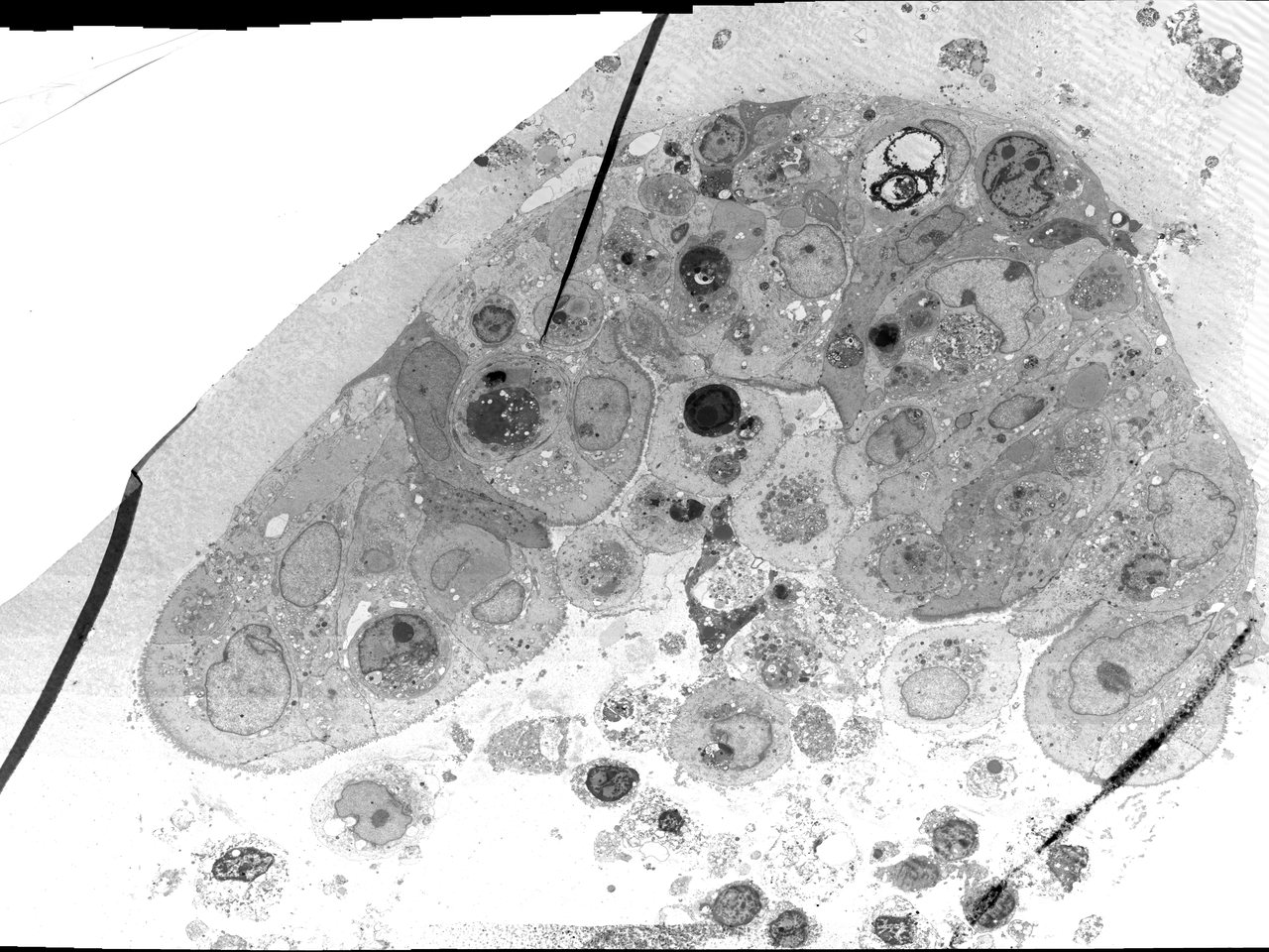 A microscope image of human gut cells grown in the lab